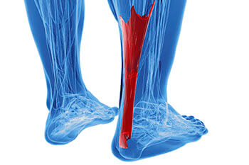 Achilles tendonitis treatment in the Cook County, IL: Chicago (Cicero, Evanston, Skokie, Berwyn, Oak Park, Park Ridge, Niles, Morton Grove, Elmwood Park, Melrose Park, Maywood, Norridge, Forest Park) areas