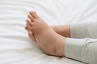 Pregnancy Can Produce Swollen Feet